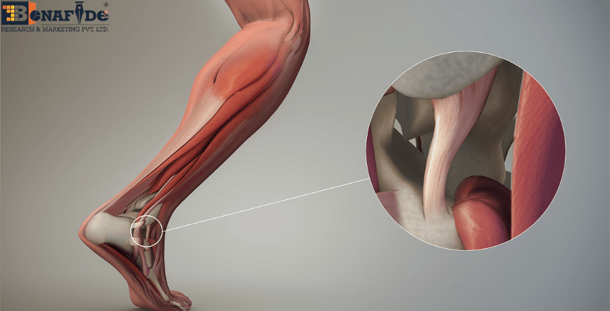 Global soft tissue repair market to reach USD 20.51 billion by 2030, driven by rising sports injuries, aging population, and advancements in surgical technologies.